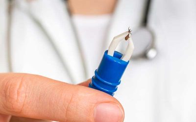 Ten Things You Need to Know About Ticks